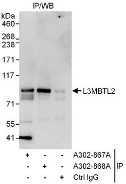 L3MBTL2 Rabbit anti-Human, Polyclonal, Bethyl Laboratories 100 &mu;L; Unconjugated:Antibodies,