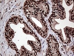 L3MBTL3 Mouse anti-Human, Clone: OTI6D7, lyophilized, TrueMAB 100 &mu;g;