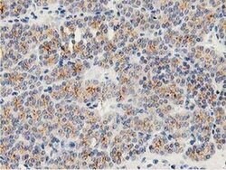 LACTB2 Monoclonal Antibody (OTI3A5), TrueMAB , OriGene 100 &mu;L | Buy Online | Origene Technologies | Fisher Scientific