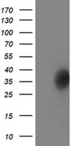 LACTB2 Monoclonal Antibody (OTI3A5), TrueMAB , OriGene 100 &mu;L | Buy Online | Origene Technologies | Fisher Scientific