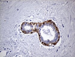LAD1 Mouse anti-Human, Clone: OTI7H8, liquid, TrueMAB 100 &mu;L; Unconjugated:Antibodies,