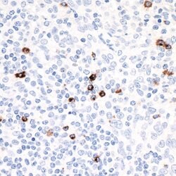 LAG3 Recombinant Rabbit Monoclonal Antibody (BLR027F), Bethyl Laboratories