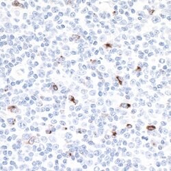LAG3 Recombinant Rabbit Monoclonal Antibody (BLR028F), Bethyl Laboratories