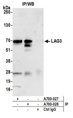 LAG3 Recombinant Rabbit Monoclonal Antibody (BLR028F), Bethyl Laboratories