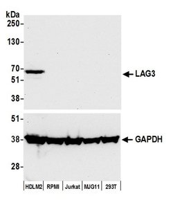 LAG3 Recombinant Rabbit Monoclonal Antibody (BLR027F), Bethyl Laboratories