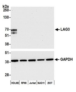 LAG3 Recombinant Rabbit Monoclonal Antibody (BLR028F), Bethyl Laboratories