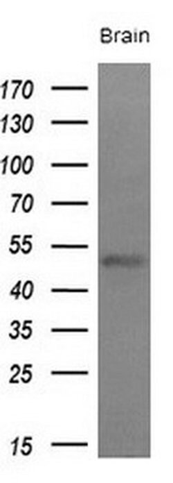 LAG3 Monoclonal Antibody (OTI5C3), TrueMAB , OriGene 100 &mu;L; Unconjugated:Antibodies,