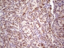 LAMA4 Monoclonal Antibody (OTI5G8), TrueMAB , OriGene 100 &mu;L; Unconjugated:Antibodies,