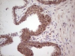 LAMA4 Monoclonal Antibody (OTI5G8), TrueMAB , OriGene 100 &mu;L; Unconjugated:Antibodies,
