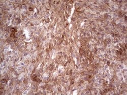 LAMA4 Monoclonal Antibody (OTI5G8), TrueMAB , OriGene:Antibodies:Primary