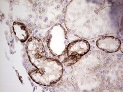 LAMA4 Monoclonal Antibody (OTI5G8), TrueMAB , OriGene 100 &mu;L; Unconjugated:Antibodies,