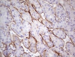 LAMA4 Monoclonal Antibody (OTI5G8), TrueMAB , OriGene:Antibodies:Primary