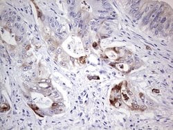 LAMB3 Monoclonal Antibody (OTI2D11), TrueMAB , OriGene:Antibodies:Primary