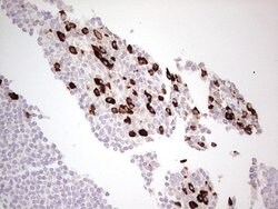 LAMB3 Mouse anti-Human, Clone: OTI1H10, lyophilized, TrueMAB 100 &mu;g;
