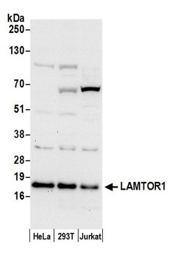 LAMTOR1 Rabbit anti-Human, Polyclonal, Bethyl Laboratories 100 &mu;L; Unconjugated:Antibodies,