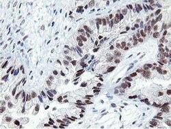 LANCL2 Monoclonal Antibody (OTI1C5), TrueMAB , OriGene 100 &mu;L | Buy Online | OriGene | Fisher Scientific