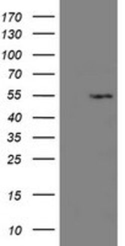 LANCL2 Mouse anti-Human, Clone: OTI1C5, lyophilized, TrueMAB 100 &mu;g;