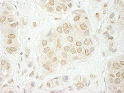 LAP1B Polyclonal Antibody, Bethyl Laboratories:Antibodies:Primary Antibodies