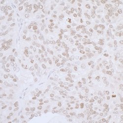 LAP2 alpha/TMPO Rabbit anti-Human, Polyclonal, Bethyl Laboratories 100