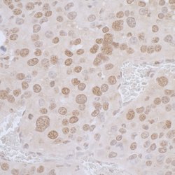 LAP2 alpha/TMPO Rabbit anti-Human, Polyclonal, Bethyl Laboratories 100