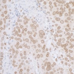 LAP2 alpha beta gamma/TMPO Rabbit anti-Human, Polyclonal, Bethyl Laboratories