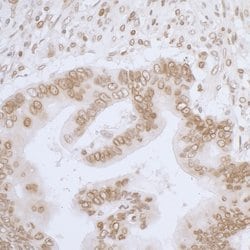 LAP2 alpha beta gamma/TMPO Rabbit anti-Human, Polyclonal, Bethyl Laboratories