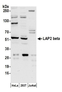 LAP2 beta/TMPO Rabbit anti-Human, Polyclonal, Bethyl Laboratories 100 &mu;L | Buy Online | Bethyl Laboratories, Inc | Fisher Scientific