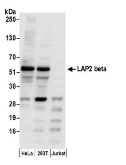 LAP2 beta gamma/TMPO Polyclonal Antibody, Bethyl Laboratories 20 &mu;L | Buy Online | Bethyl Laboratories, Inc | Fisher Scientific