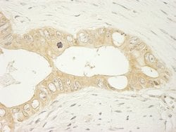 LARP1 Polyclonal Antibody, Bethyl Laboratories 10 &mu;L; Unconjugated:Antibodies,