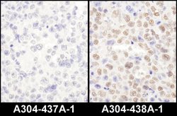 LAS1L Rabbit anti-Human, Mouse, Polyclonal, Bethyl Laboratories 100 &mu;L;