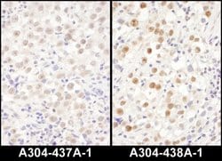 LAS1L Rabbit anti-Human, Mouse, Polyclonal, Bethyl Laboratories 100 &mu;L;
