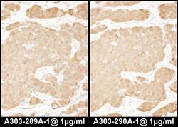 LASP1 Rabbit anti-Human, Polyclonal, Bethyl Laboratories 100 &mu;L; Unconjugated:Antibodies,
