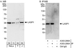 LASP1 Rabbit anti-Human, Polyclonal, Bethyl Laboratories 100 &mu;L; Unconjugated:Antibodies,