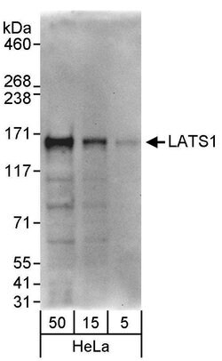 LATS1 Rabbit anti-Human, Mouse, Polyclonal, Bethyl Laboratories 100 &mu;L;