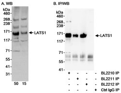 LATS1 Rabbit anti-Human, Mouse, Polyclonal, Bethyl Laboratories 100 &mu;L;
