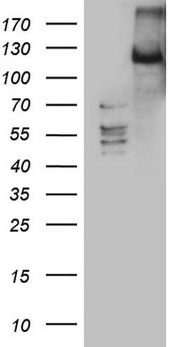LATS2 Mouse anti-Human, Clone: OTI2D3, lyophilized, TrueMAB 100 &mu;g | Buy Online | Origene Technologies | Fisher Scientific