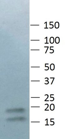 Invitrogen LC3B Polyclonal Antibody 100 &mu;L; Unconjugated:Antibodies,
