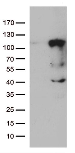 LCA5 Monoclonal Antibody (OTI1A3), TrueMAB , OriGene 100 &mu;L; Unconjugated:Antibodies,