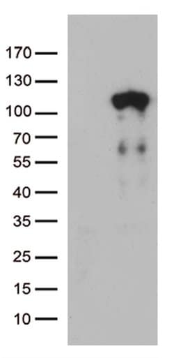 LCA5 Mouse anti-Human, Clone: OTI2D3, lyophilized, TrueMAB 100 &mu;g; Unconjugated:Antibodies,