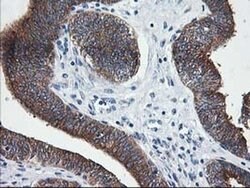 LCMT1 Mouse anti-Human, Clone: OTI 1G5, liquid, TrueMAB 100 &mu;L; Unconjugated:Antibodies,