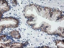 LCMT1 Mouse anti-Human, Clone: OTI 1G5, lyophilized, TrueMAB 100 &mu;g;