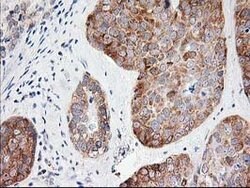 LCMT1 Mouse anti-Human, Clone: OTI 1G5, lyophilized, TrueMAB 100 &mu;g;