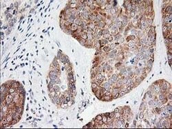 LCMT1 Mouse anti-Human, Clone: OTI 1G5, liquid, TrueMAB 100 &mu;L; Unconjugated:Antibodies,