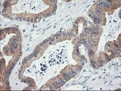 LCMT1 Mouse anti-Human, Clone: OTI 1G5, liquid, TrueMAB 100 &mu;L; Unconjugated:Antibodies,