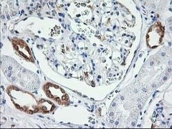 LCMT1 Mouse anti-Human, Clone: OTI 1G5, lyophilized, TrueMAB 100 &mu;g;