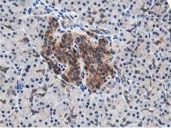 LCMT1 Mouse anti-Human, Clone: OTI4A5, lyophilized, TrueMAB 100 &mu;g;