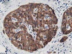 LCMT1 Mouse anti-Human, Clone: OTI4A5, lyophilized, TrueMAB 100 &mu;g;