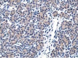 LCMT1 Mouse anti-Human, Clone: OTI4A5, lyophilized, TrueMAB 100 &mu;g;
