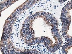 LCMT1 Mouse anti-Human, Clone: OTI4A5, lyophilized, TrueMAB 100 &mu;g;