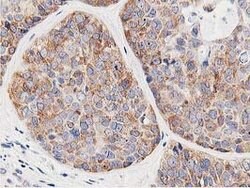 LCMT1 Mouse anti-Human, Clone: OTI4A5, lyophilized, TrueMAB 100 &mu;g;